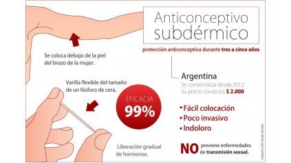 Implante subdermico y lactancia materna Implante subdermico y lactancia materna