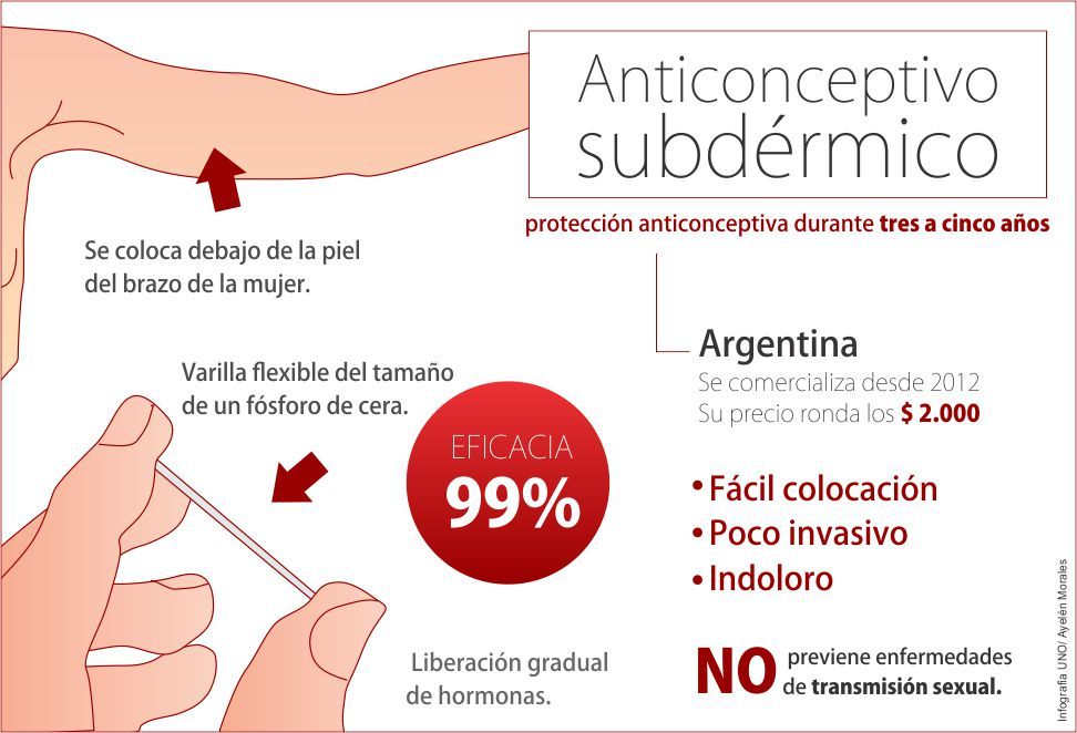 Precio implante subcutaneo anticonceptivo
