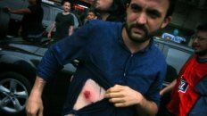 asi reprimio gendarmeria la marcha de abrazo al congreso asi reprimio gendarmeria la marcha de abrazo al congreso