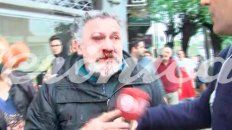 vecinos molieron a golpes al acosador de la kiosquera vecinos molieron a golpes al acosador de la kiosquera