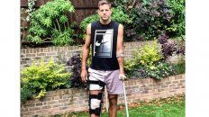 del potro se fracturo la rotula derecha del potro se fracturo la rotula derecha