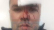 Internado. Uno de los policías debió ser internado. Le rompieron un vaso en la cabeza. Internado. Uno de los policías debió ser internado. Le rompieron un vaso en la cabeza.
