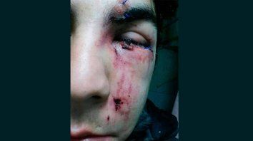 denuncian otro caso de apremios ilegales a un joven en la calle denuncian otro caso de apremios ilegales a un joven en la calle