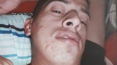 alerta en entre rios por un profugo que escapo de gendarmeria alerta en entre rios por un profugo que escapo de gendarmeria