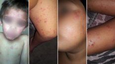 la justicia federal prohibio fumigar a menos de 1.000 metros en pergamino la justicia federal prohibio fumigar a menos de 1.000 metros en pergamino