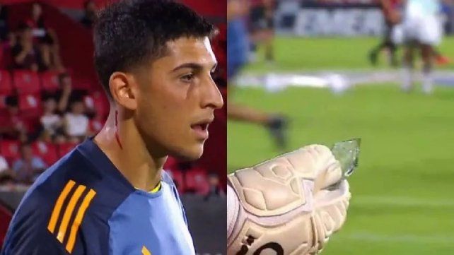 Violencia en Rosario: hinchas de Newell's le arrojaron un vidrio a Brey. Violencia en Rosario: hinchas de Newell's le arrojaron un vidrio a Brey.