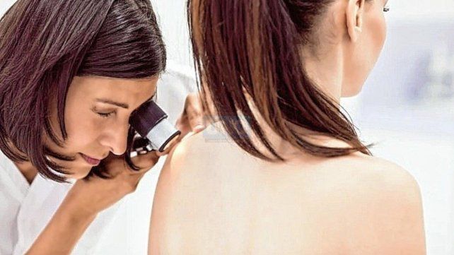 Control. Ante cualquier cambio que resulte sospechoso en las manchas o lunares, consultar al dermatólogo. Control. Ante cualquier cambio que resulte sospechoso en las manchas o lunares, consultar al dermatólogo.