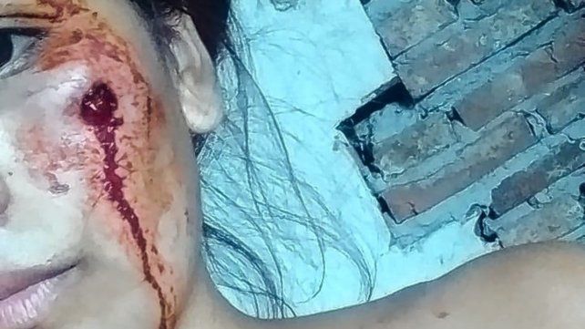 La Policía reprimió una pelea e hirió a una joven que llegaba de trabajar
