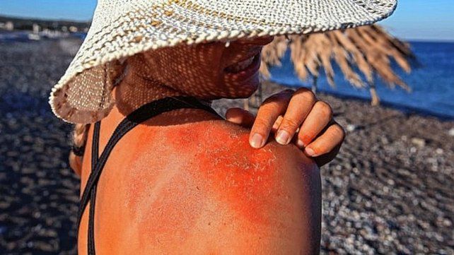 La exposición desmedida al sol es el principal causante de cáncer de piel