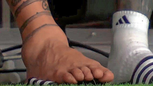 Así le quedó el tobillo a Messi, que tuvo que salir reemplazado ante Colombia. Así le quedó el tobillo a Messi, que tuvo que salir reemplazado ante Colombia.