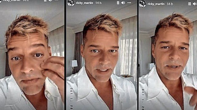 Ricky Martin enfrentó los comentarios de cirugía estética en su rostro
