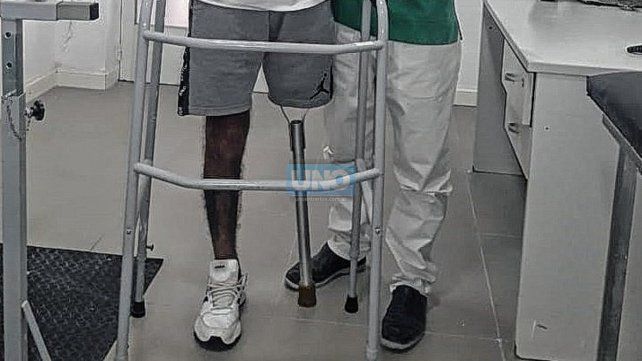 En una ortopedia le hicieron un elemento a medida que usa mientras espera la prótesis.