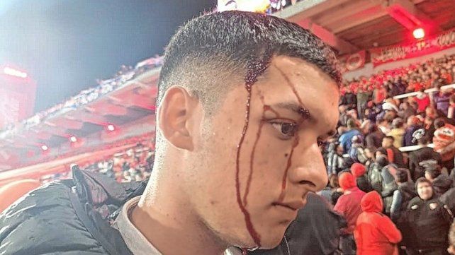 Hay hinchas de Independiente heridos. Hay hinchas de Independiente heridos.