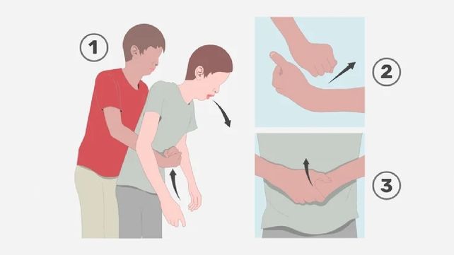 maniobra-heinlichjpg