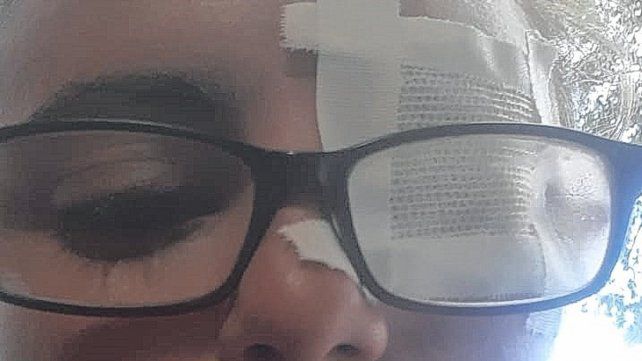 Así quedó la árbitra luego de la agresión.