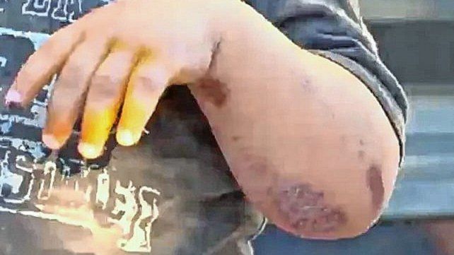Rosario: arrastraron a un bebé por la calle para robarle la mochila
