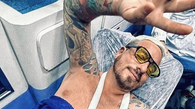 Federico Bal contó desde Brasil los detalles del serio accidente que sufrió