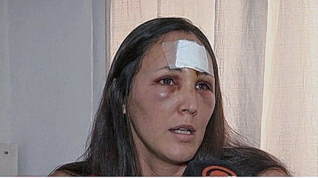 La Policía identificó a los autores de la agresión. La educadora que trabaja en la zona de Paraná sentenció que ese tipo de casos de violencia lo sufren a diario