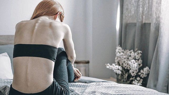 Trastornos alimentarios afectan sobre todo a adolescentes.