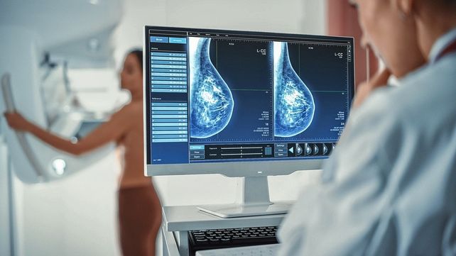 Detección. La mamografía es el estudio más eficaz para determinar de forma temprana la presencia de un tumor.
