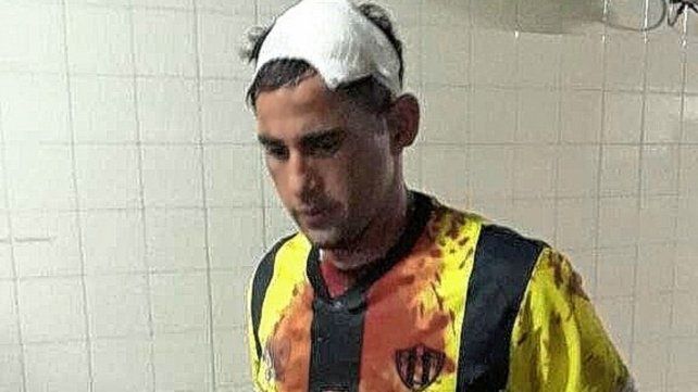 Federico Batista fue herido.