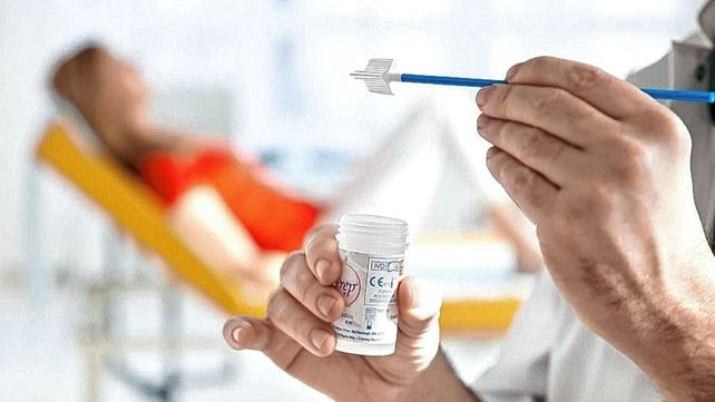 Autotoma del test VPH. Autotoma del test VPH.