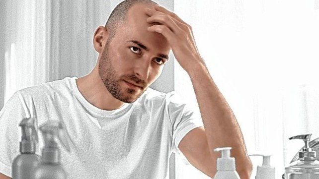 Los implantes y los tratamientos capilares son los más demandados por los varones, de diversas edades