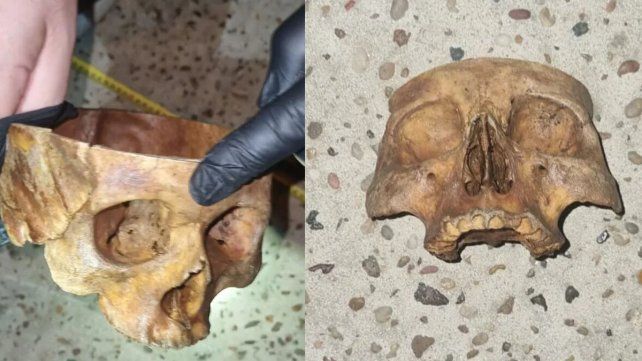 Una vecina encontró un cráneo en una calle de General Ramírez. Una vecina encontró un cráneo en una calle de General Ramírez.