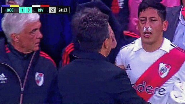 Aliendro y su rostro.