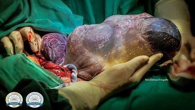 La foto de Nora Dalmasso que obtuvo reconocimiento en la categoría "Delivery" del concurso.