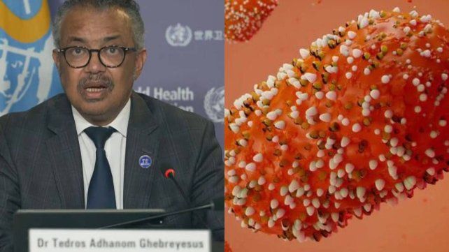 La OMS declaró la emergencia global por el crecimiento de la viruela símica en varios países. Es la segunda vez que lo hace en los últimos dos años La OMS declaró la emergencia global por el crecimiento de la viruela símica en varios países. Es la segunda vez que lo hace en los últimos dos años